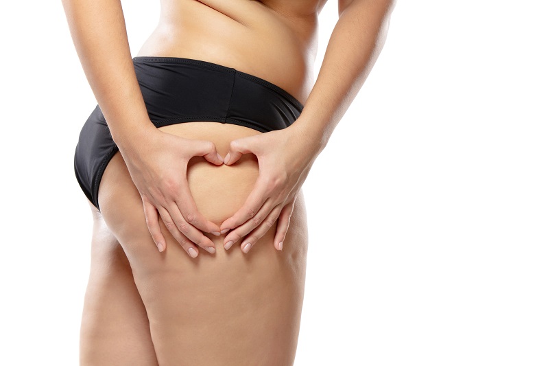 Na czym polega lipolifting? Zastosowanie i efekty zabiegu