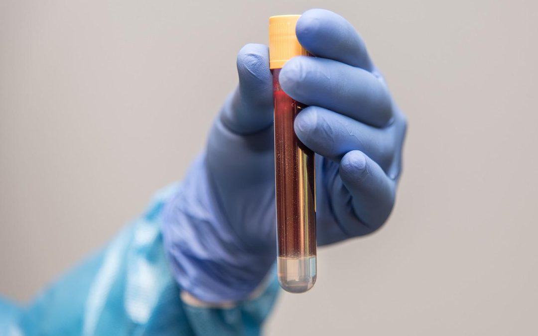 Jaką funkcję pełni osocze bogatopłytkowe w medycynie estetycznej? Sprawdźmy to.